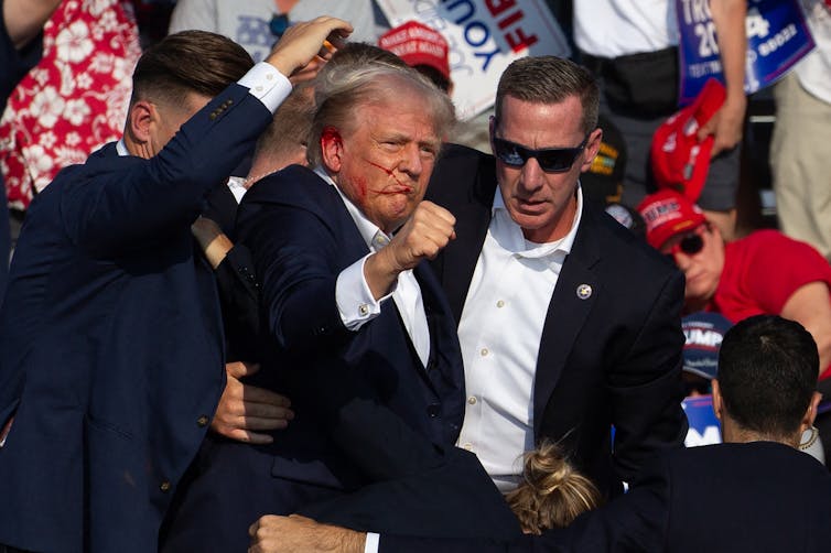 A man with blood on his face holds up a clenched fist while people in suits surround him.