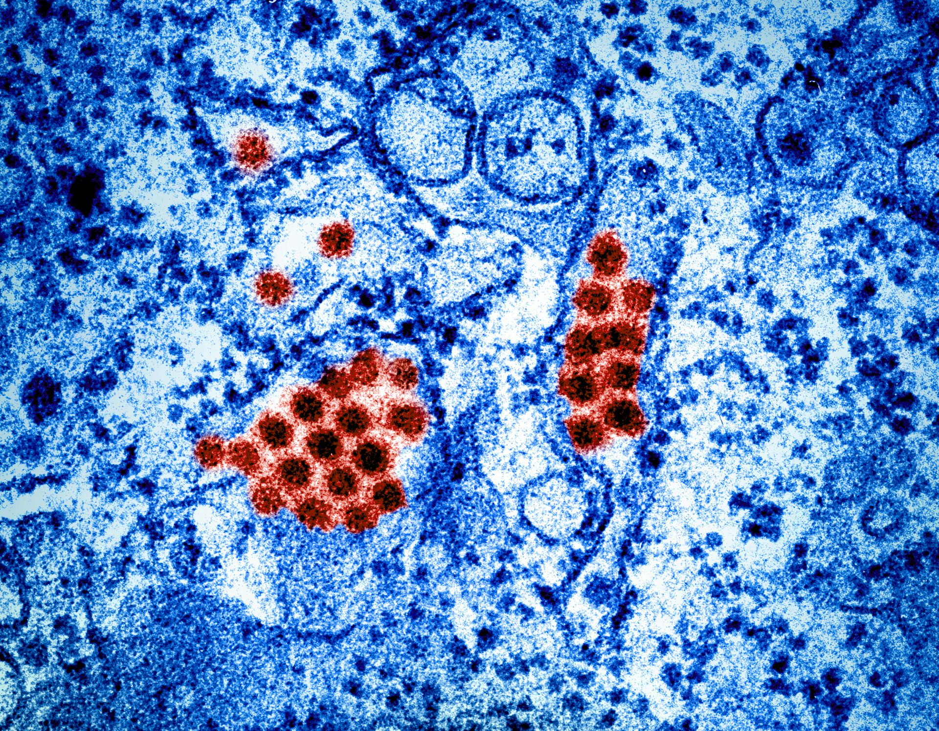 Micrographie électronique à transmission de particules du virus de la dengue (rouge, fausses couleurs).