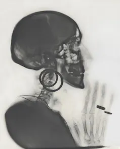 Una radiografía de una cabeza, un torso y unas manos en la que la persona lleva pendientes y anillos.