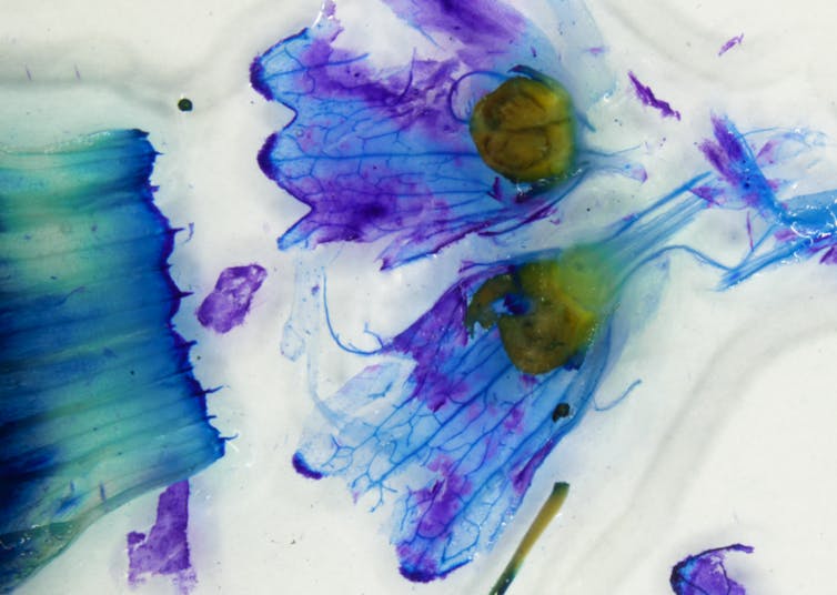 boxthorn flower under microscope