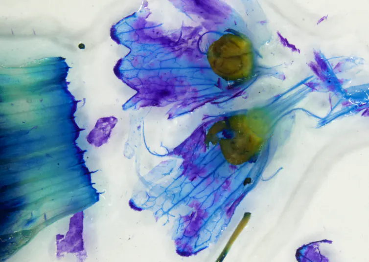 boxthorn flower under microscope