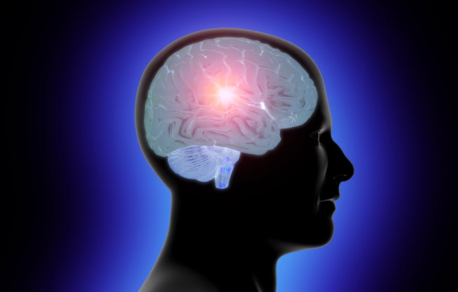 More brains. Умная голова. Мозг просветленного человека. Высшая нервная деятельность фото. Мозг влюбленного человека фото.