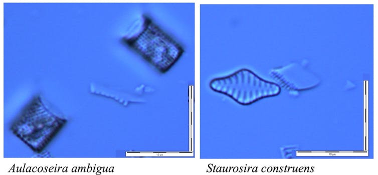 Organizmy oglądane przez mikroskop są oświetlone w kolorze ciemnoniebieskim na jasnoniebieskim tle