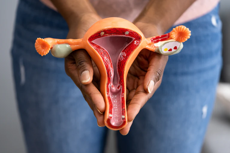 A woman holds a medical model of the uterus.