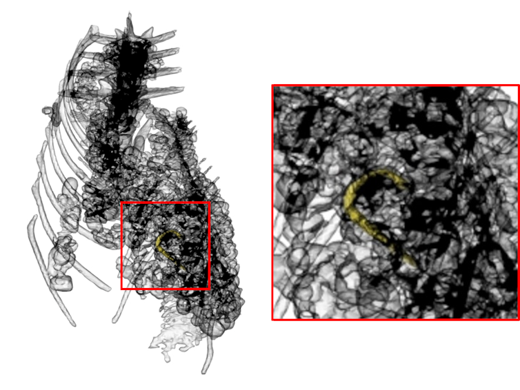Black and white scans showing the metal hook still inside the crocodile.