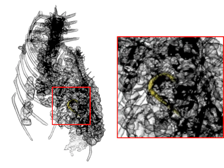 Black and white scans showing the metal hook still inside the crocodile.
