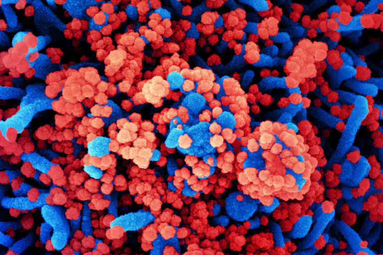 Micrographie électronique en fausses couleurs de particules virales de SARS-CoV-2 à la surface d’une cellule infectée.