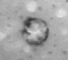 Vesícula extracelular procedente de líquido sinovial. Fotografía producida con microscopía electrónica de transmisión (TEM) (200 nm)