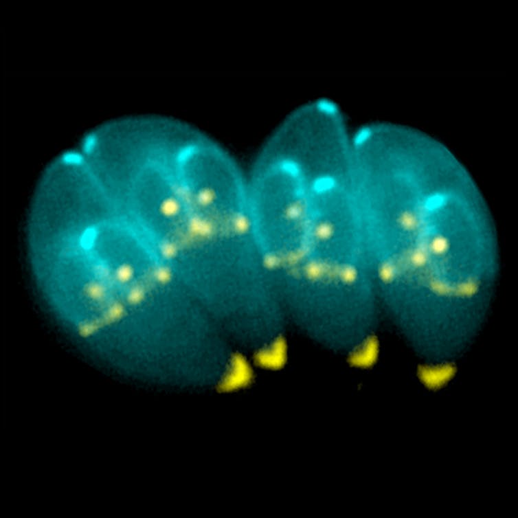 Microscopy image of four teal colored oblong blobs with smaller oblong blobs within each