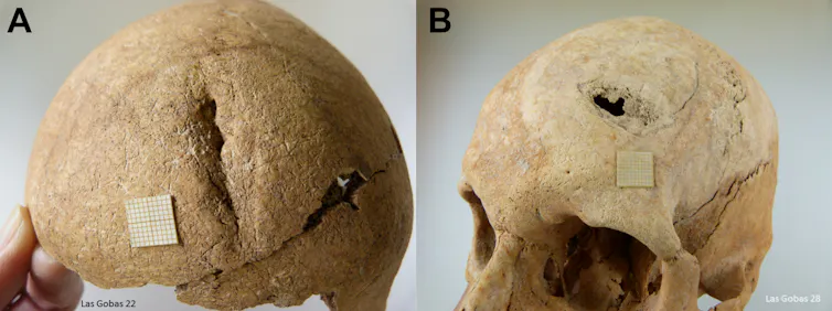 Skulls from Las Gobas showing evidence of violence.