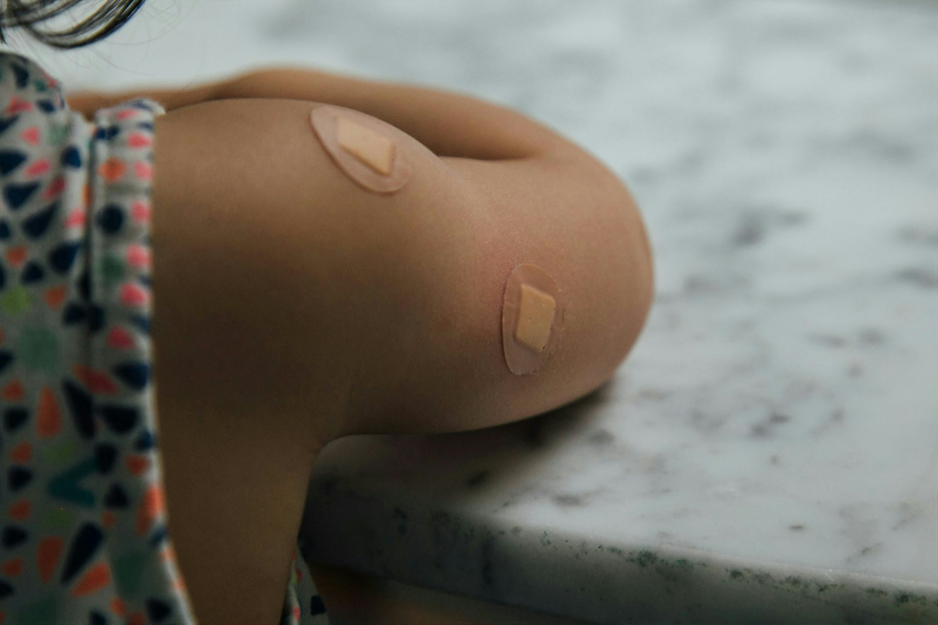 A child's upper arm with two circular bandaids.