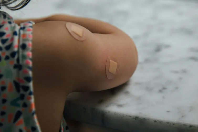 A child's upper arm with two circular bandaids.