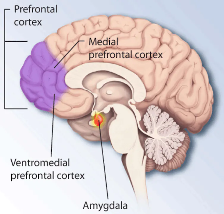 A diagram of the human brain with the prefrontal cortex highlighted at the front.