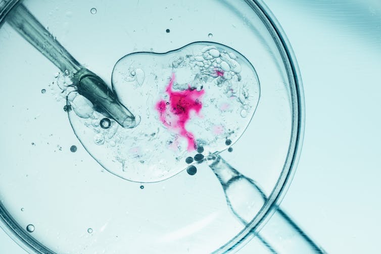 Close up of a laboratory IVF insemination.