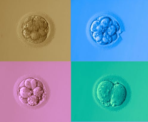 Can AI pick IVF embryos as well as a human? First randomised controlled trial shows promise