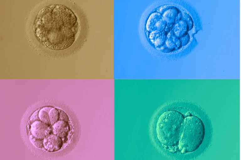 Microscope image of multiple clumps of cells.