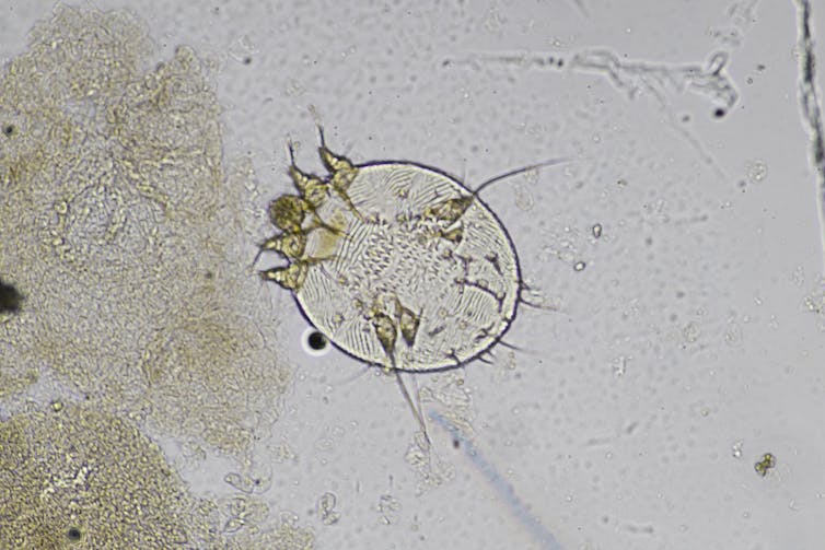 _Sarcoptes scabiei_ under a microscope.
