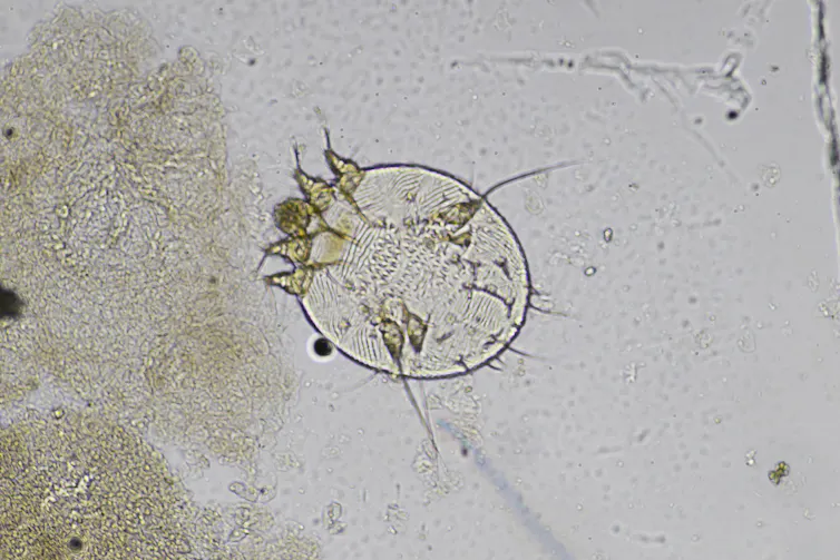 _Sarcoptes scabiei_ under a microscope.