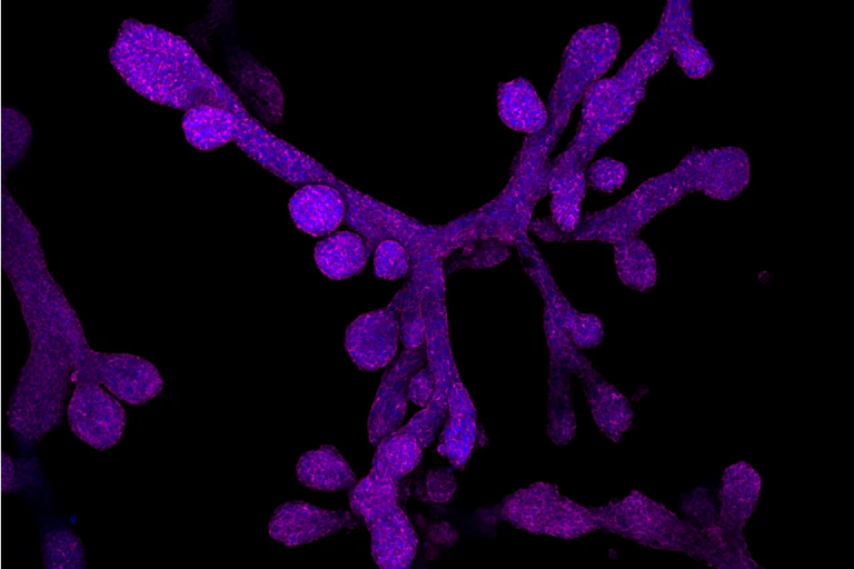 Microscopy image of branch-like cells with globular blooms, stained purple