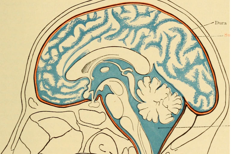 Illustration of cross-section of brain with fluid within its cavities