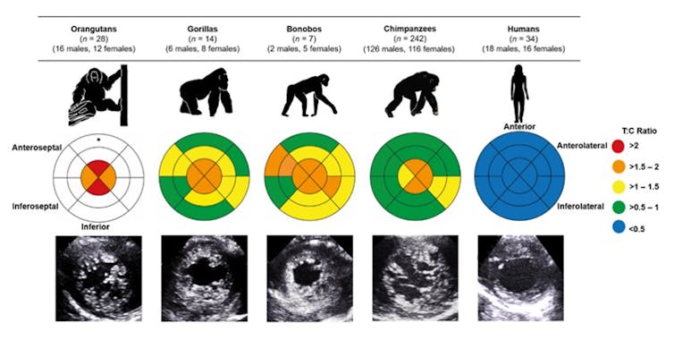 An illustration comparing the heart trabeculation of great apes.