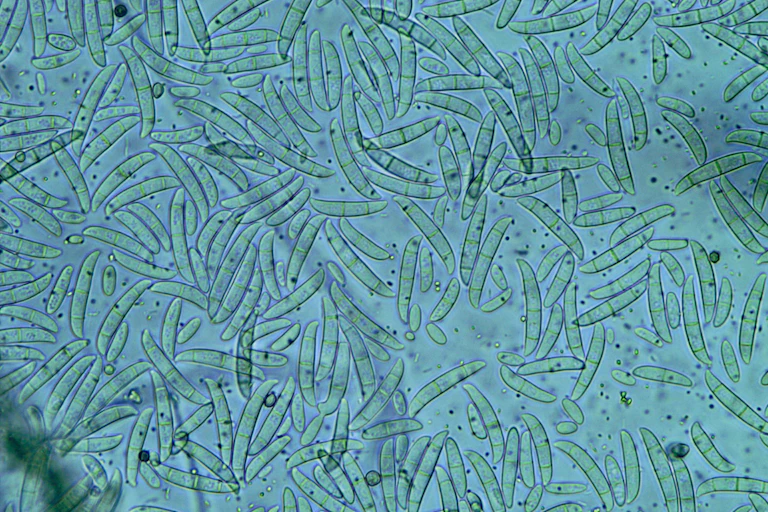 Microscopy image of many thin, translucent rod-like fungal spores against a teal background