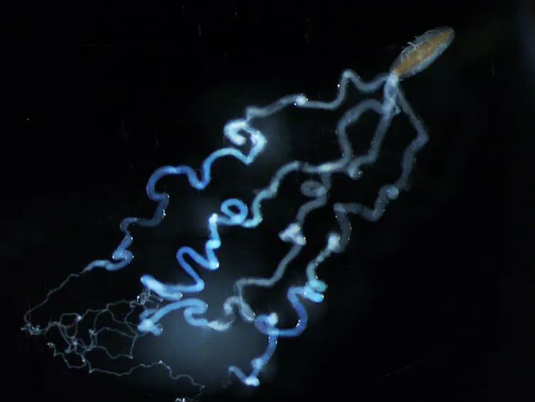 A virus which looks like a grain of rice with several long, wavy tendrils coming out of its end