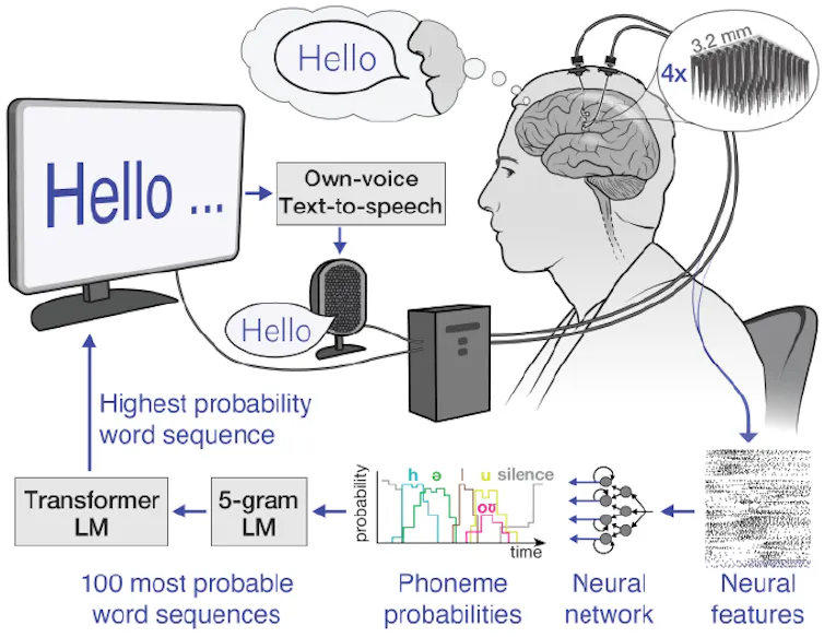 Diagram showing a man, his brain, wires and a computer screen