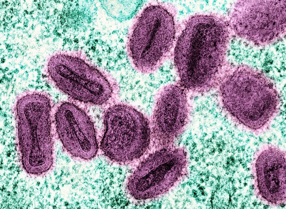 Épidémie de mpox : quels enjeux en France et à l’international