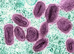 Particules du virus mpox (rose), dans une cellule infectée (verte) cultivée en laboratoire, vues au microscope électronique à transmission après coloration