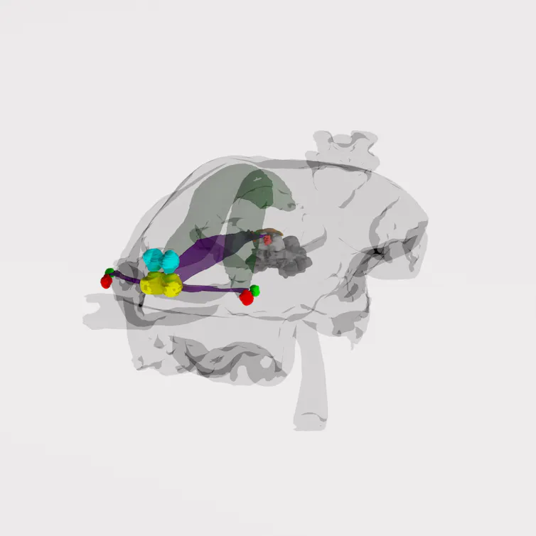 Scan of spider's brain