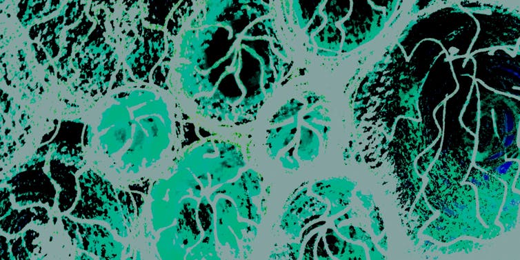 Vírus visto através de um microscópio eletrônico.