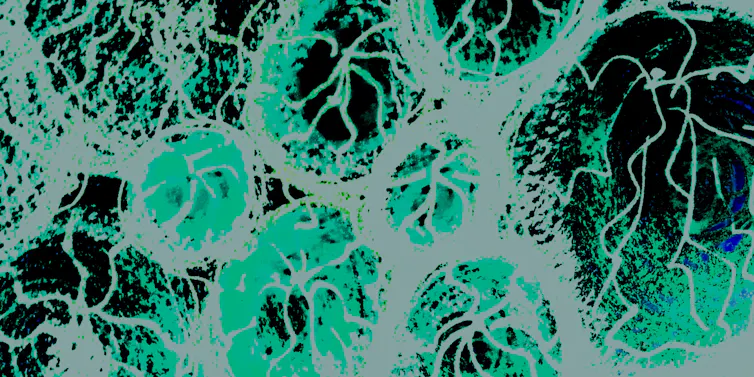 Virus seen through an electron microscope.
