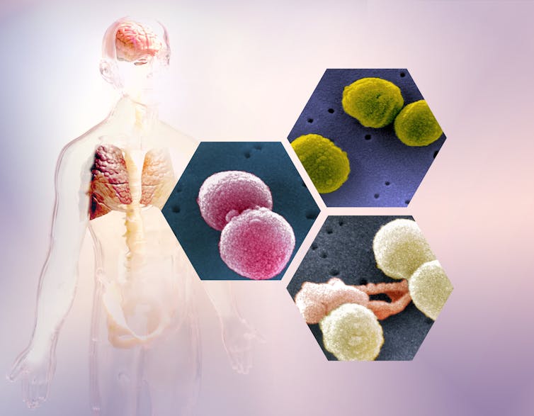 Model of the human body and three close-up scanning electron microscope images of Strepotococcus pneumoniae bacteria.