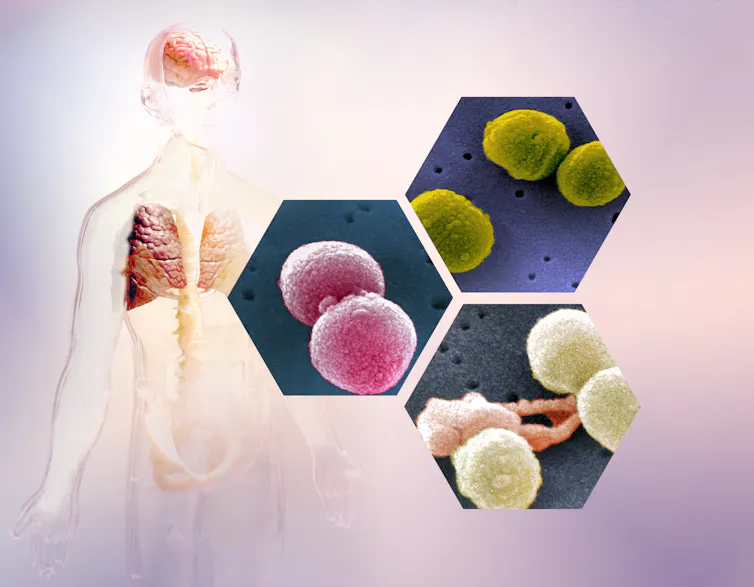 Modèle du corps humain et trois images rapprochées de bactéries Strepotococcus pneumoniae prises au microscope électronique à balayage