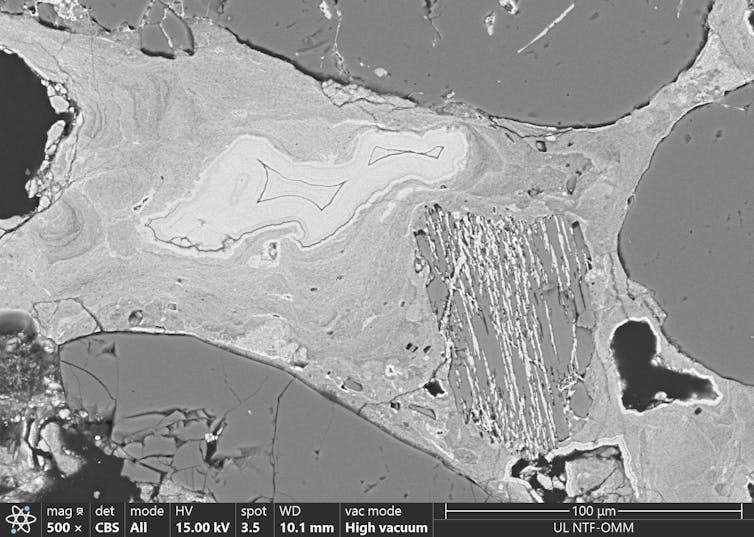 Greyscale electron microscope image of various shaded blobs.