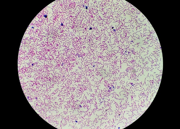 Microscope image of tiny purple rods scattered in a round viewfinder.