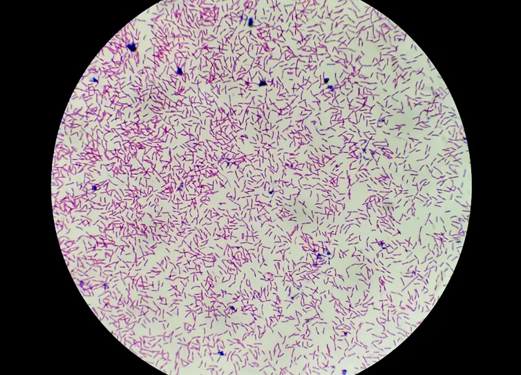 Microscope image of tiny purple rods scattered in a round viewfinder.