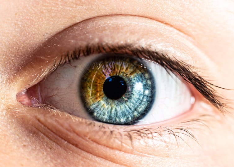 A picture of an eye, which is half brown and half blue.