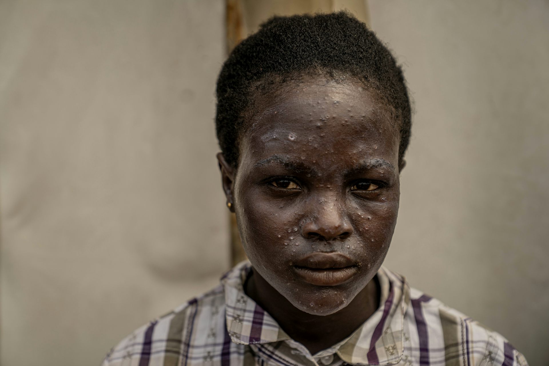 IOC-UN AIDS MANUAL PORT 1-28 Prova 02, image size:1356x668