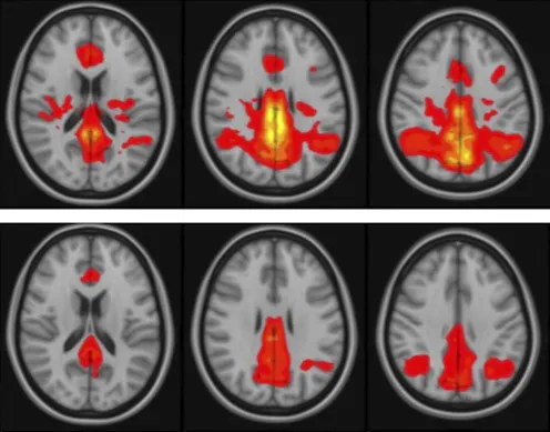 Normal Ravi Functional brain imaging – News, Research and Analysis – The ...
