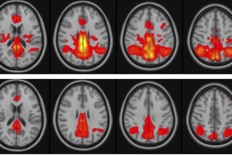 Two rows of brain images