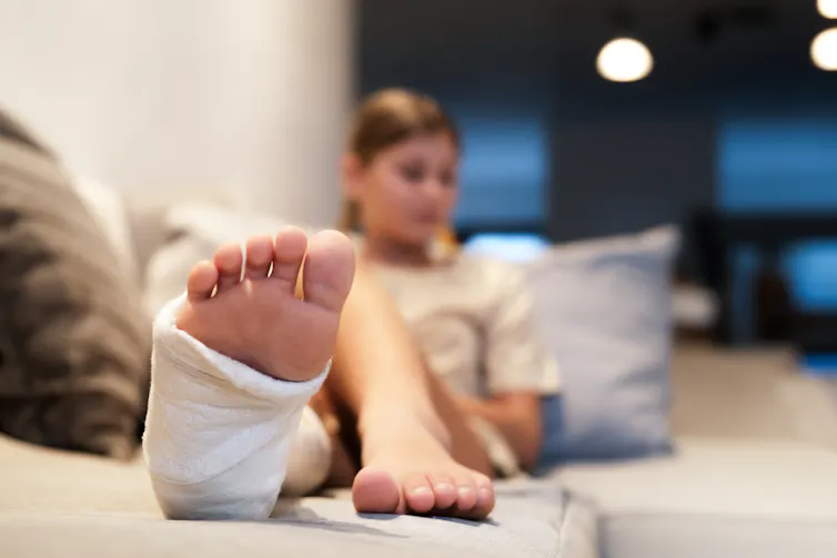 A teenage girl in a cast lies on a couch.