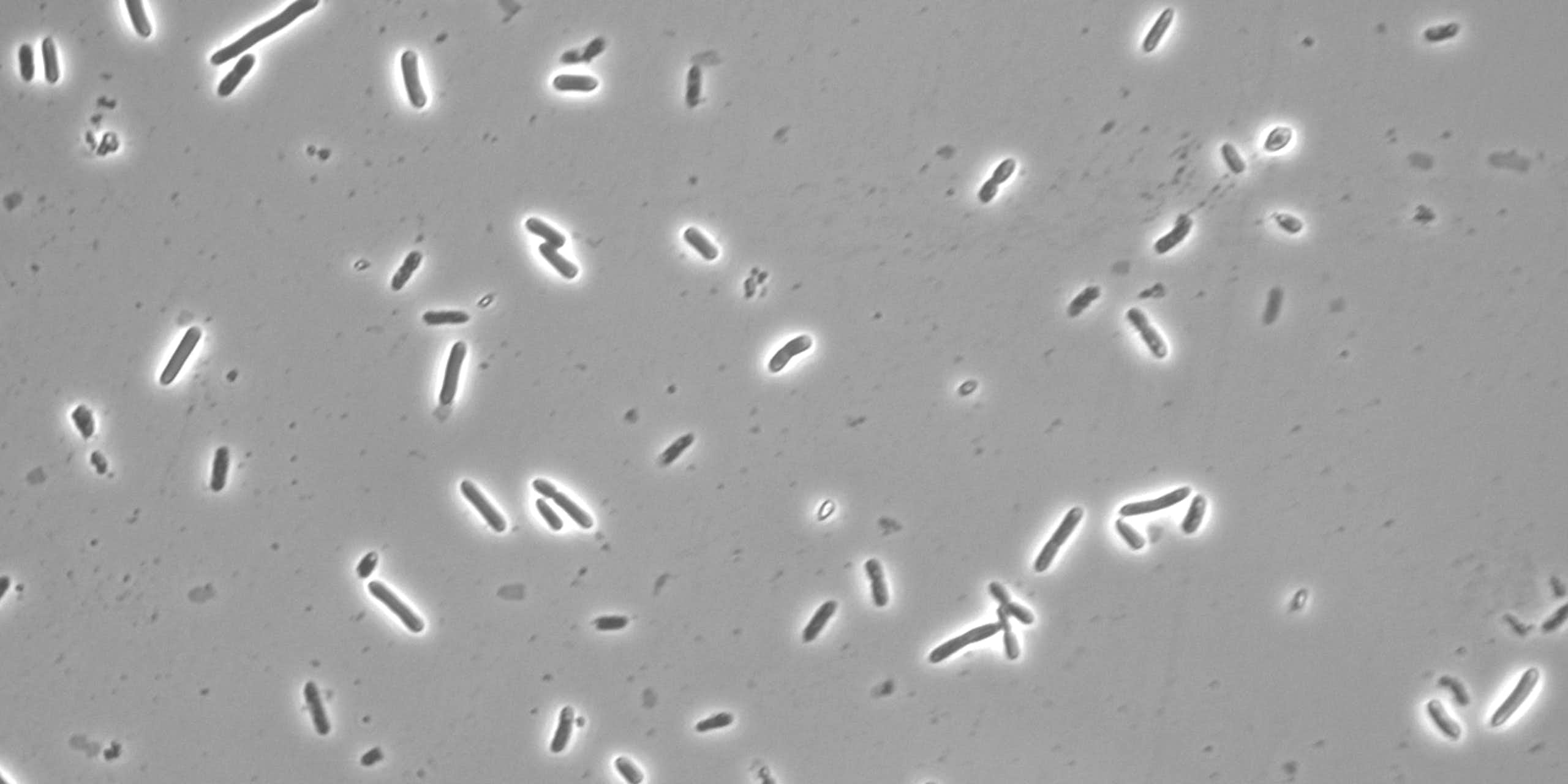 close up of rod-shaped microbes on grey background from microscope