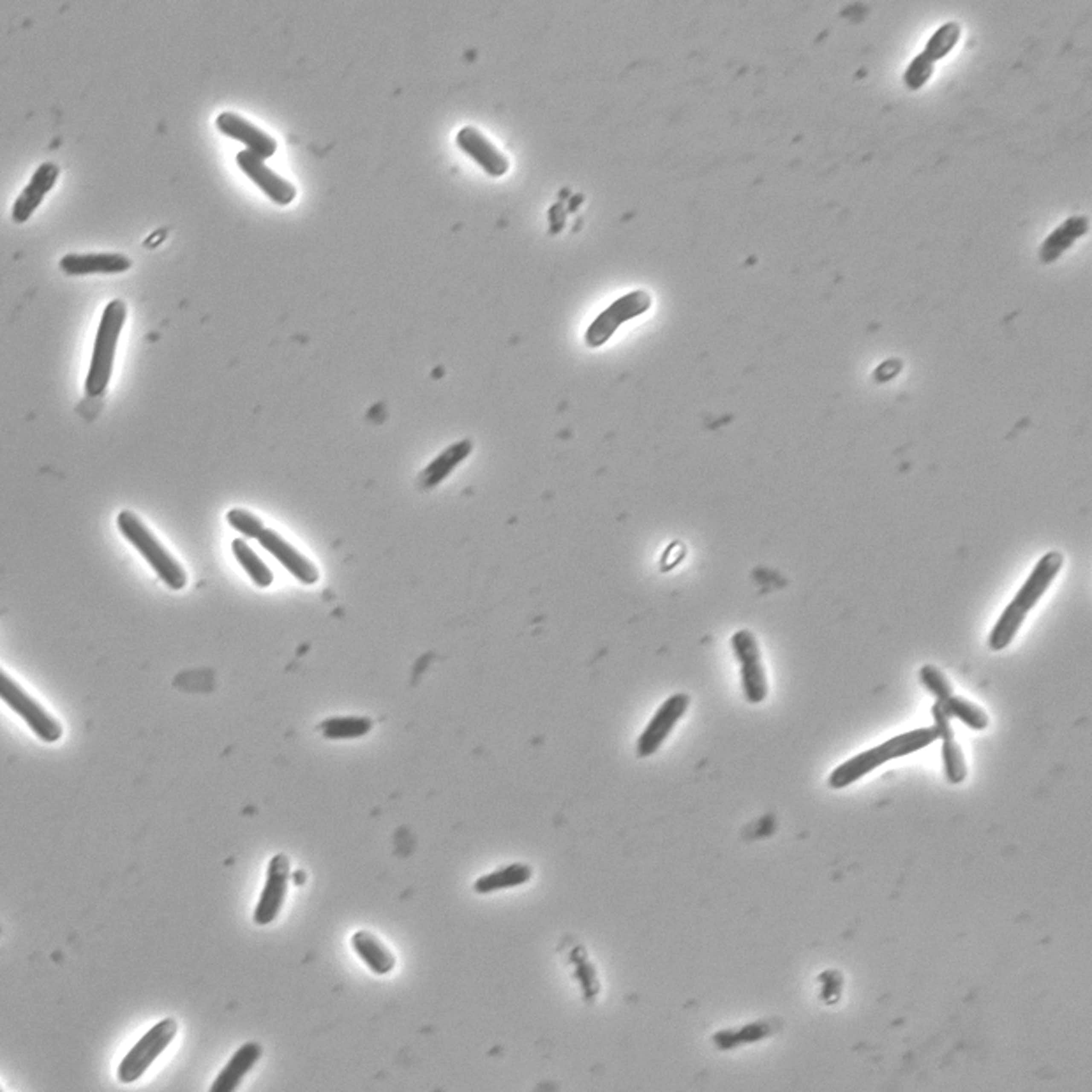 close up of rod-shaped microbes on grey background from microscope