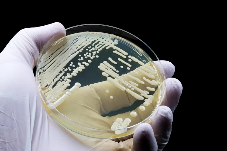 Candida auris on a petri dish