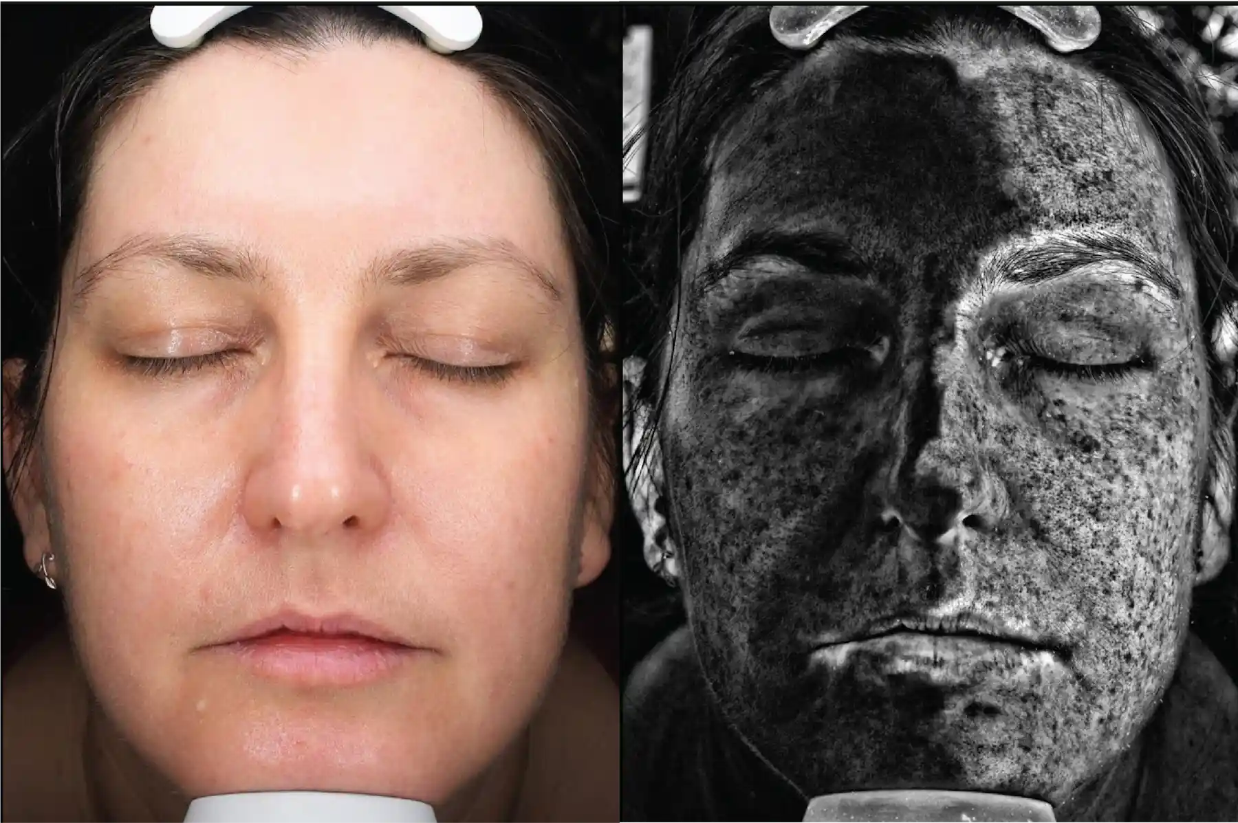 Caseoh Using Sunscreen Yes, You Still Need To Use Sunscreen, Despite What Youโve Heard On TikTok