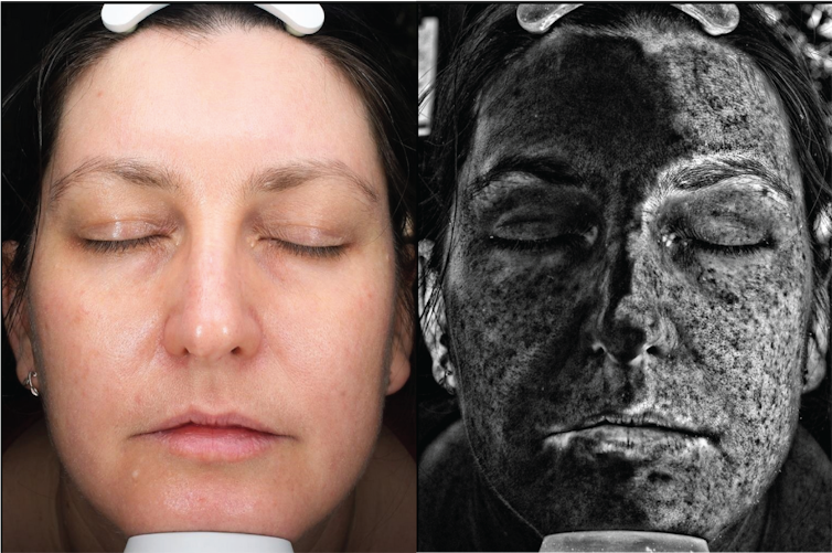 Woman's face under visible light and UV, showing how sunscreen that is not visible to the naked eye absorbs and scatters UV light. The left side of the face has sunscreen on and the right does not.