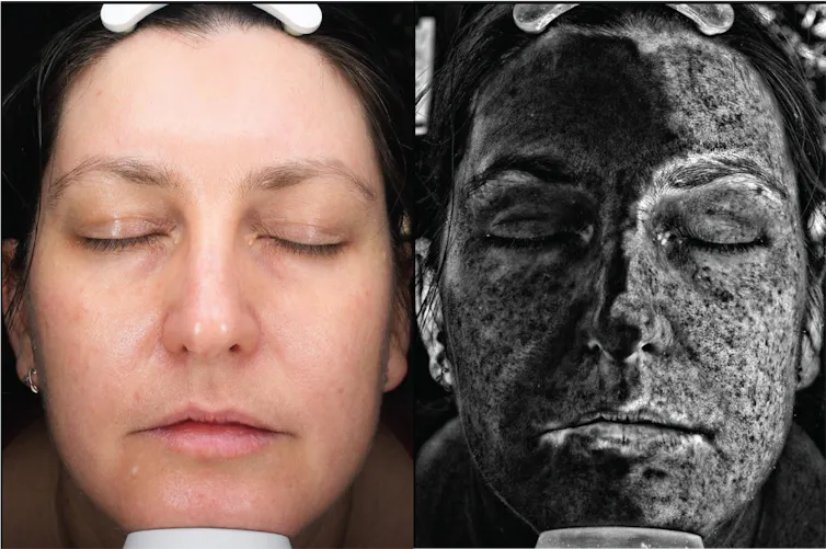 Woman's face under visible light and UV, showing how sunscreen that is not visible to the naked eye absorbs and scatters UV light. The left side of the face has sunscreen on and the right does not.