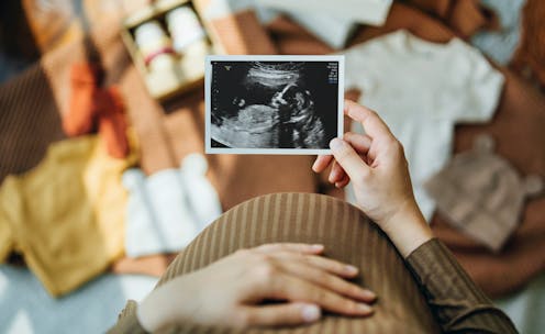 New Zealand’s BMI threshold for publicly funded fertility treatment is outdated and unethical. Here’s why it should go